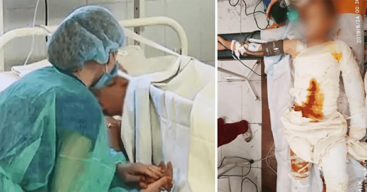 8-year-old fighting for his life in hospital after bullies set him on fire – he needs all our prayers