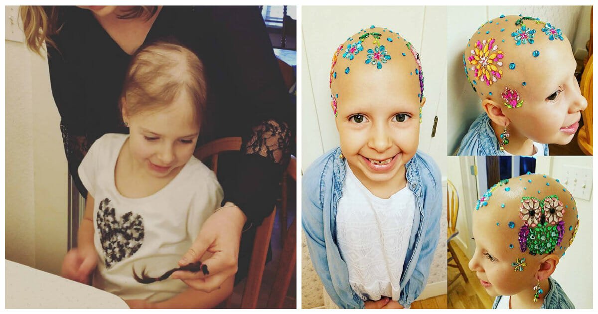 Little girl with alopecia permanently loses hair, but finds beauty in baldness by decorating her head