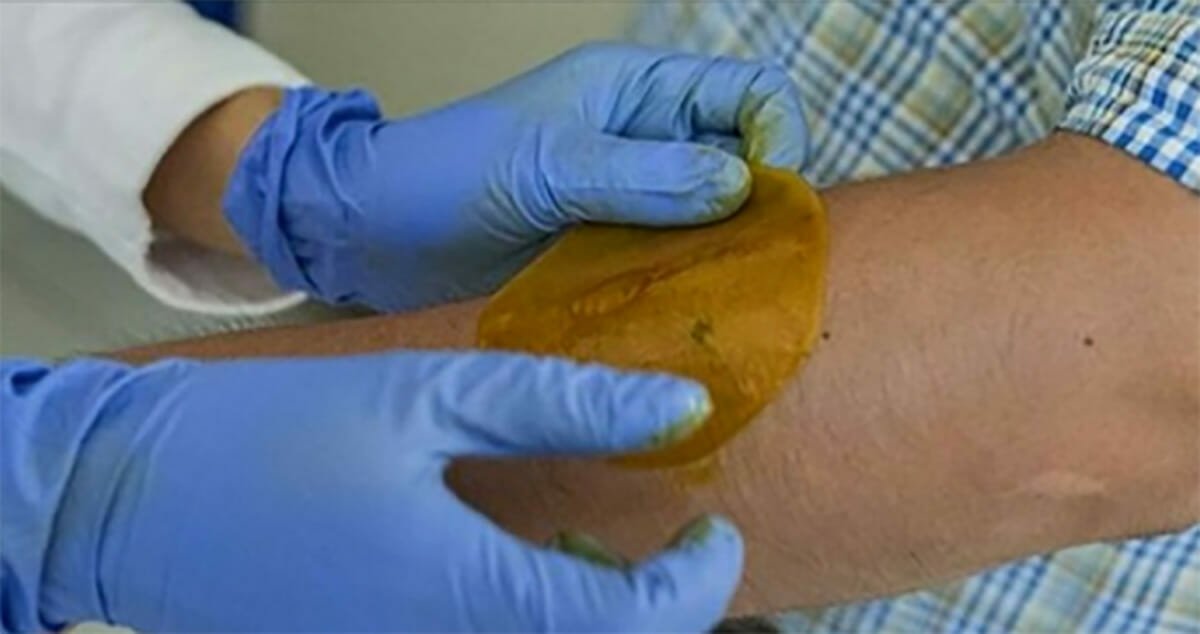 New patch invented to help those with diabetes