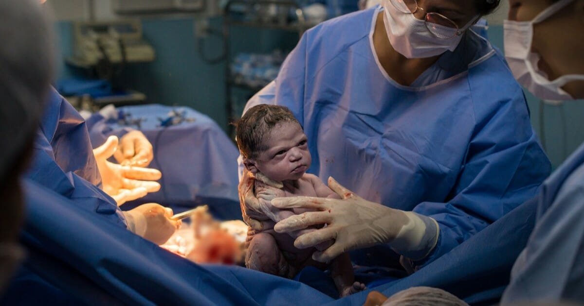 Unimpressed newborn stares down doctor in hilarious viral photo